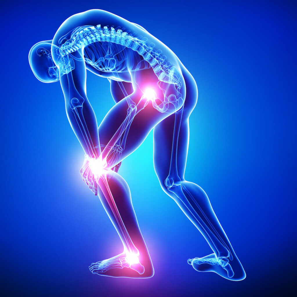 Wondering How You Can Reduce Your Joint Pain and Improve Your Mobility? Try Physical Therapy